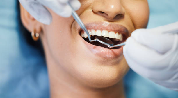 Best Emergency Treatment for Dental Infections or Abscesses in Ignacio, CO