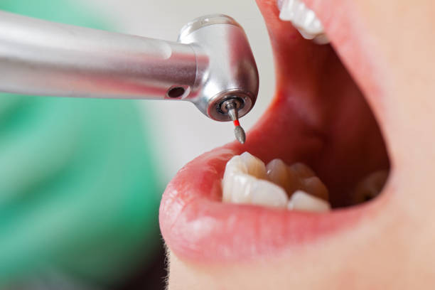 Best Pediatric Emergency Dentist in Ignacio, CO